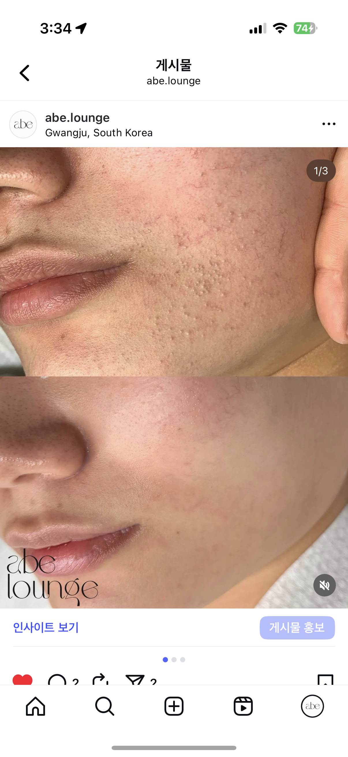 에이브라운지 에스테틱