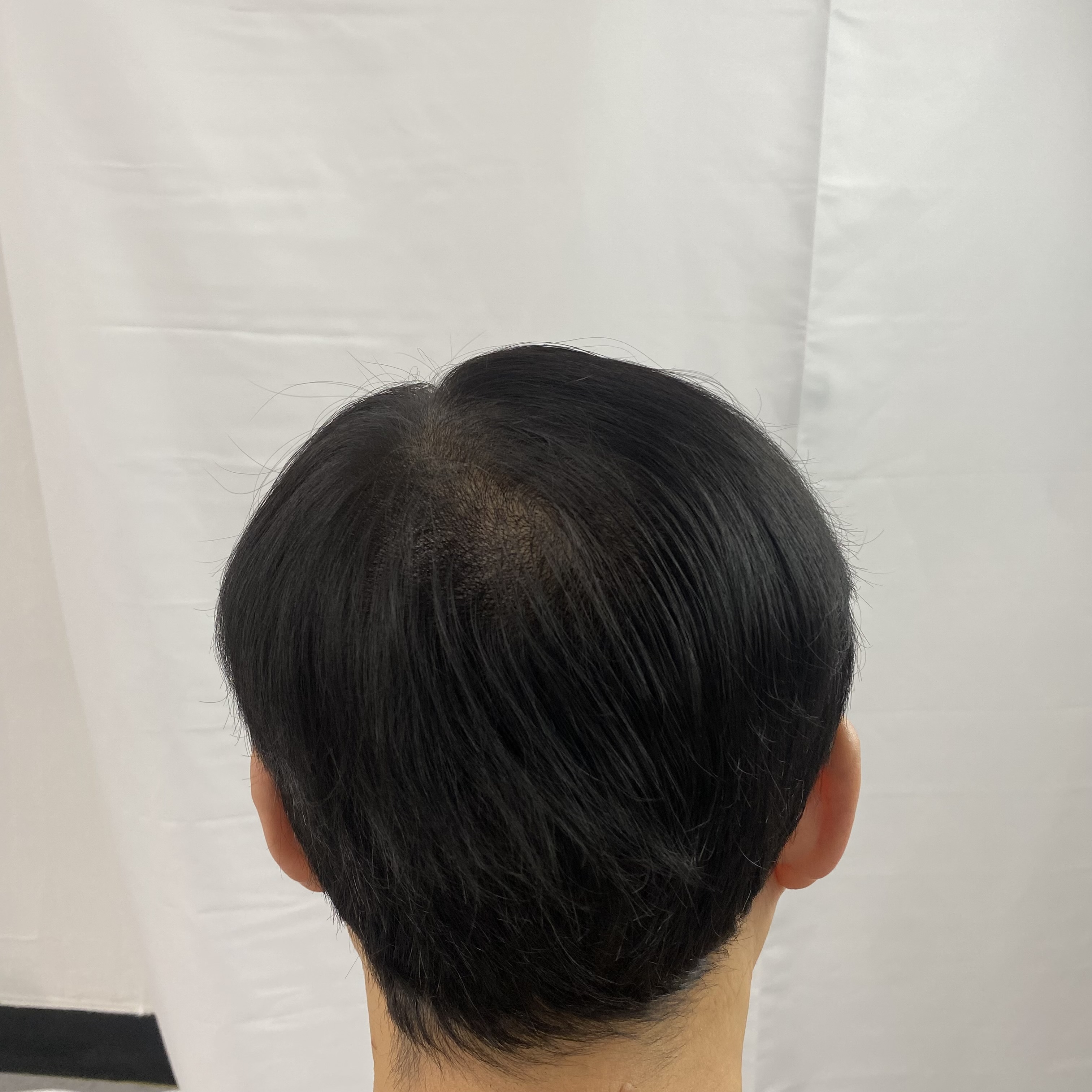 쓰담스칼프 대표 이미지