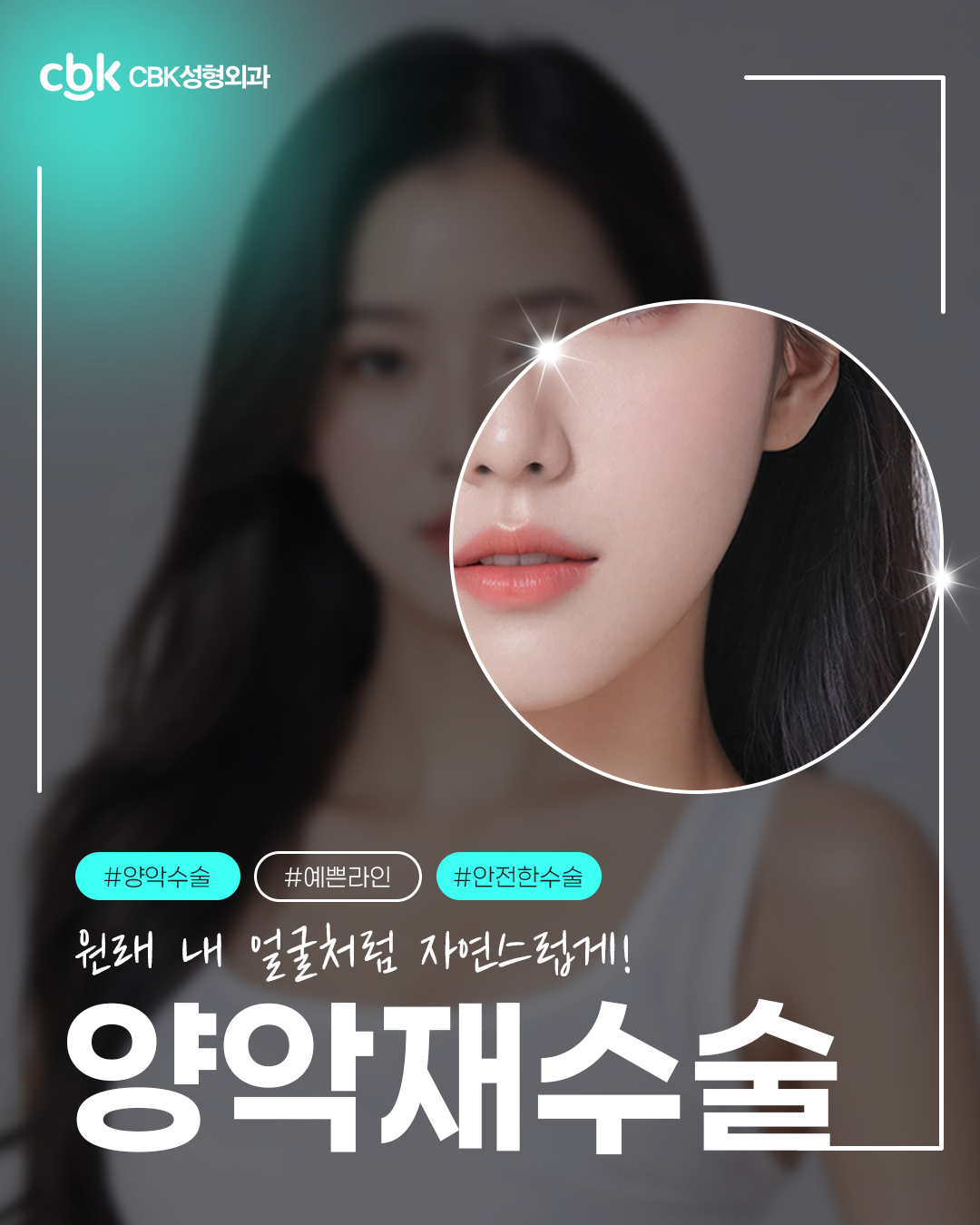 CBK성형외과 대표 이미지