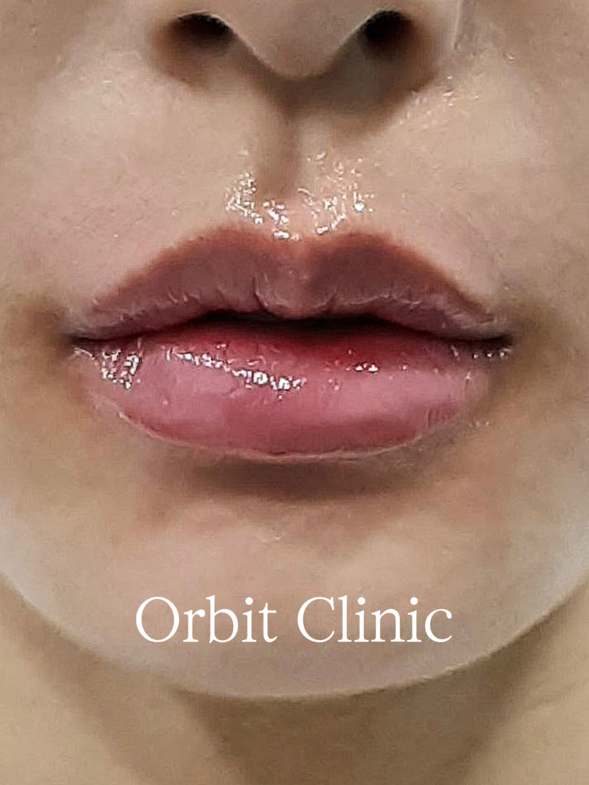 오빗의원 대표 이미지
