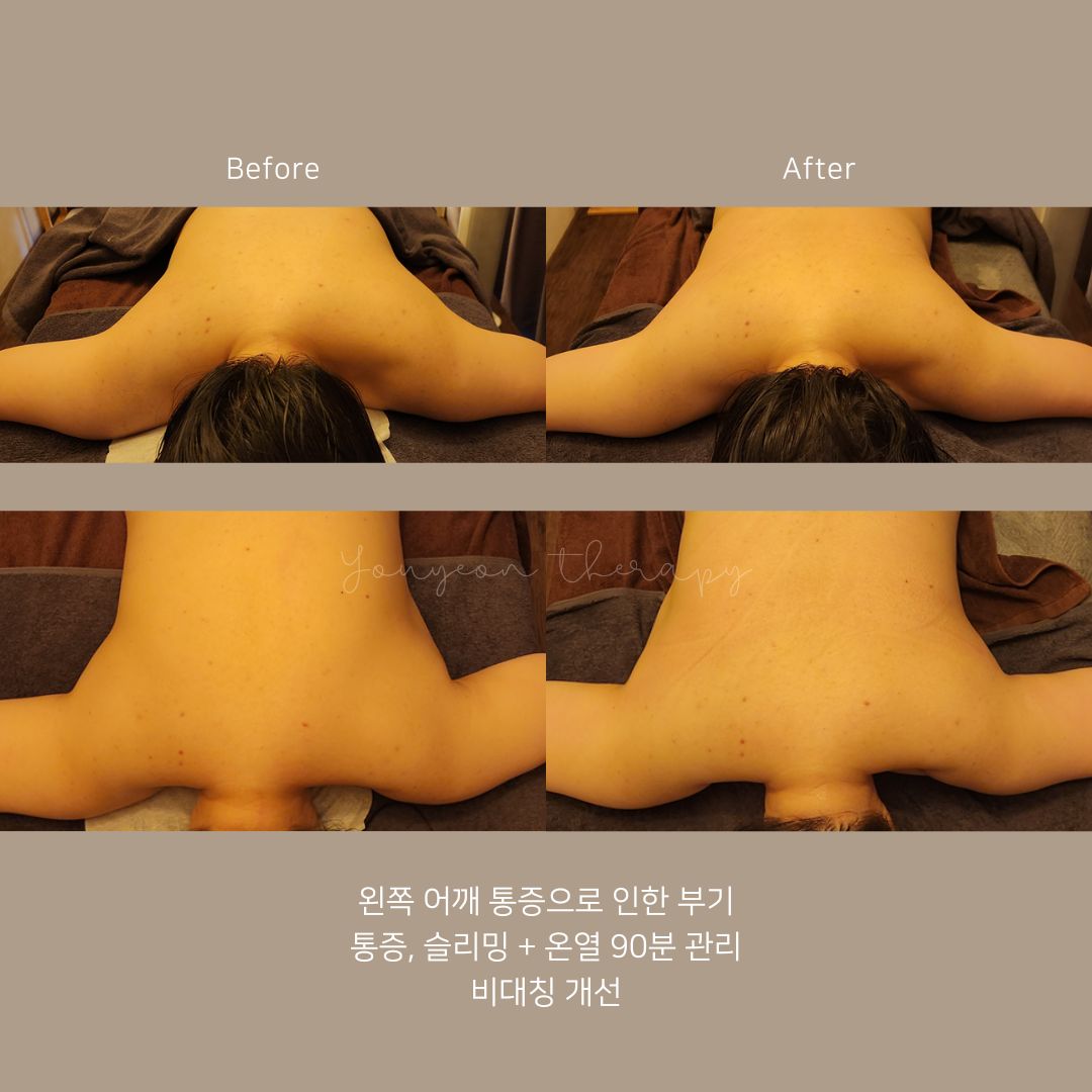 유연테라피 photo 8
