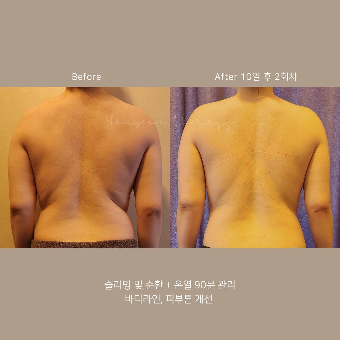 유연테라피 photo 9