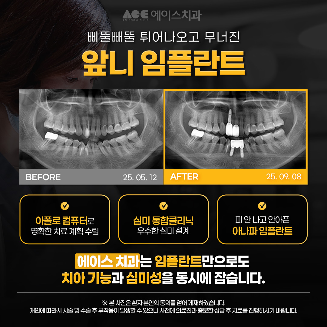 정관에이스치과 대표 이미지