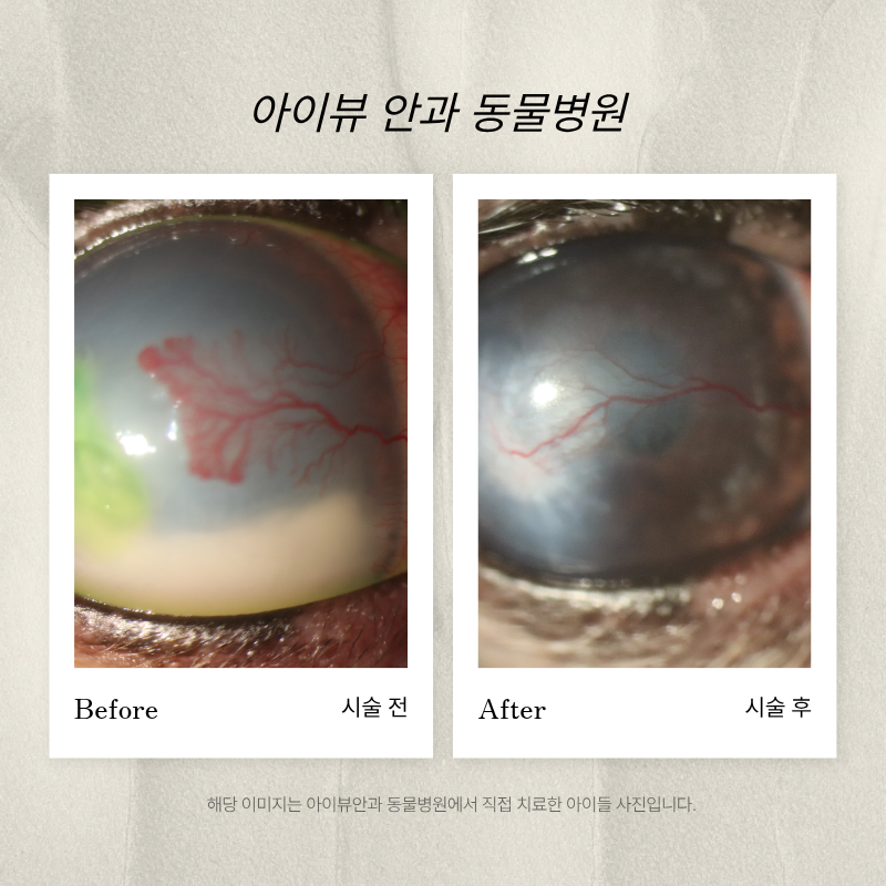 마포아이뷰안과 이미지
