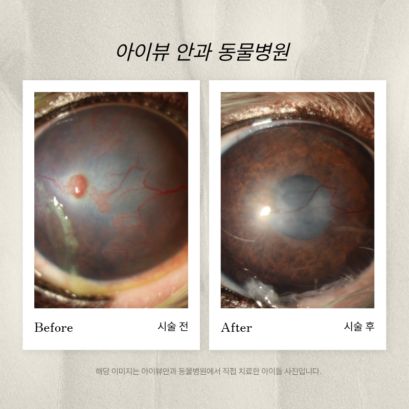 마포아이뷰안과 대표 이미지