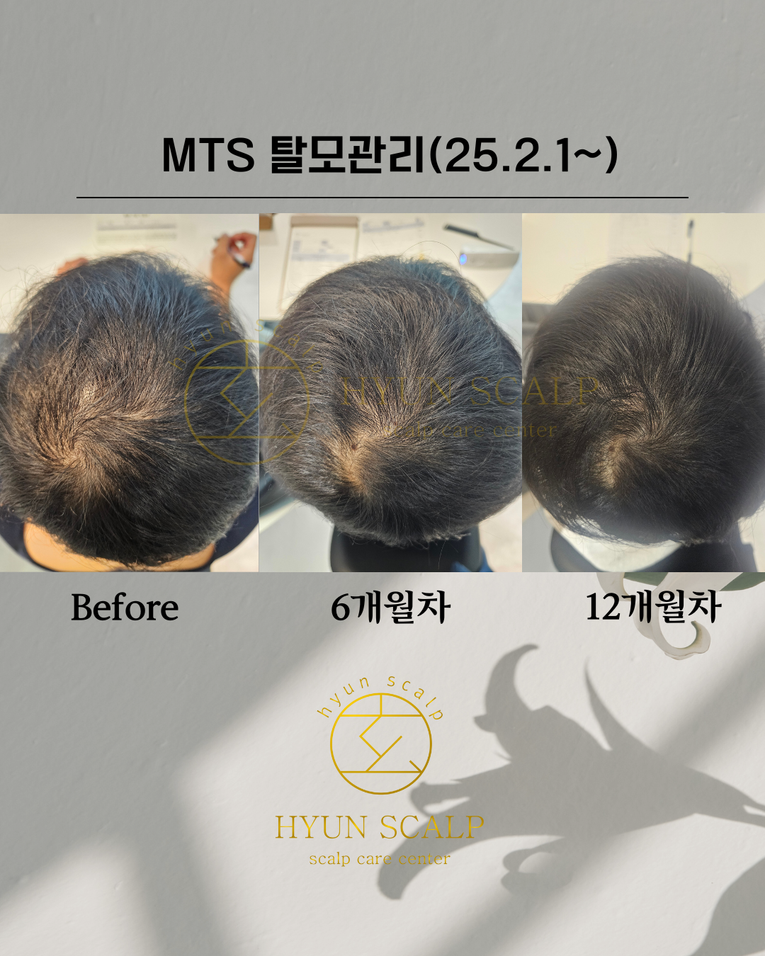 현스칼프 이대점 대표 이미지