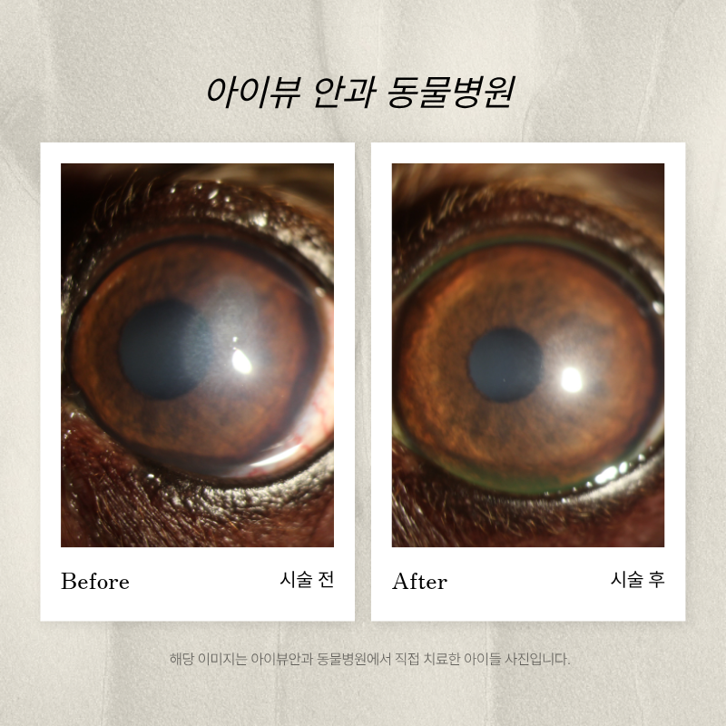 마포아이뷰안과 대표 이미지