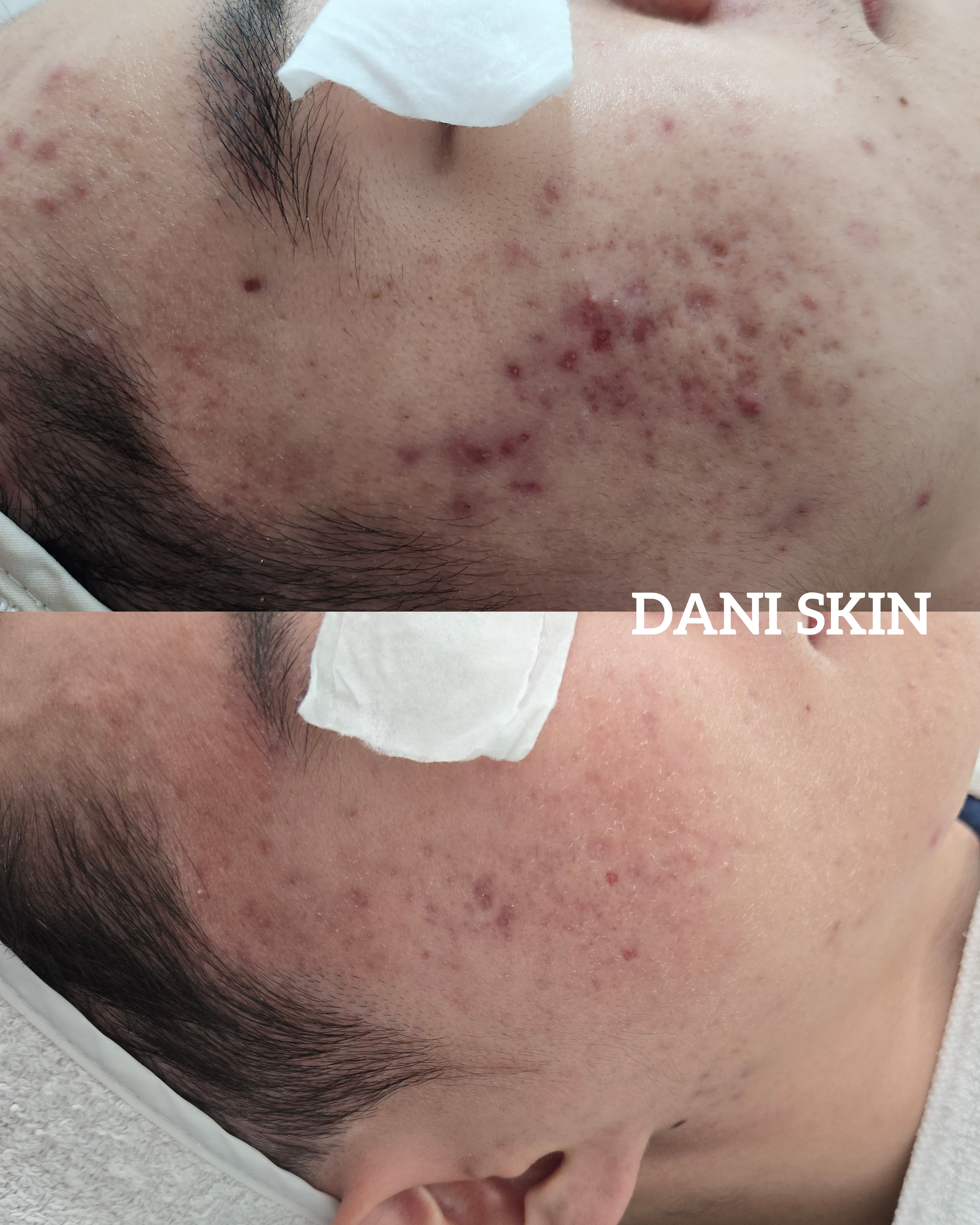 다니스킨 대표 이미지