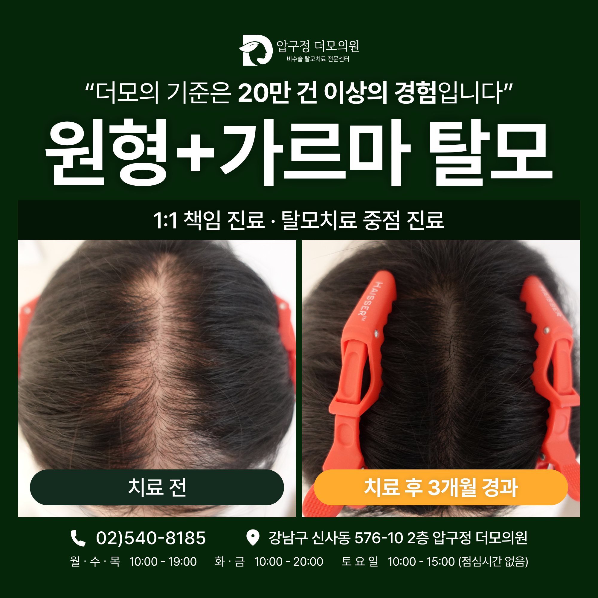 압구정더모의원 대표 이미지