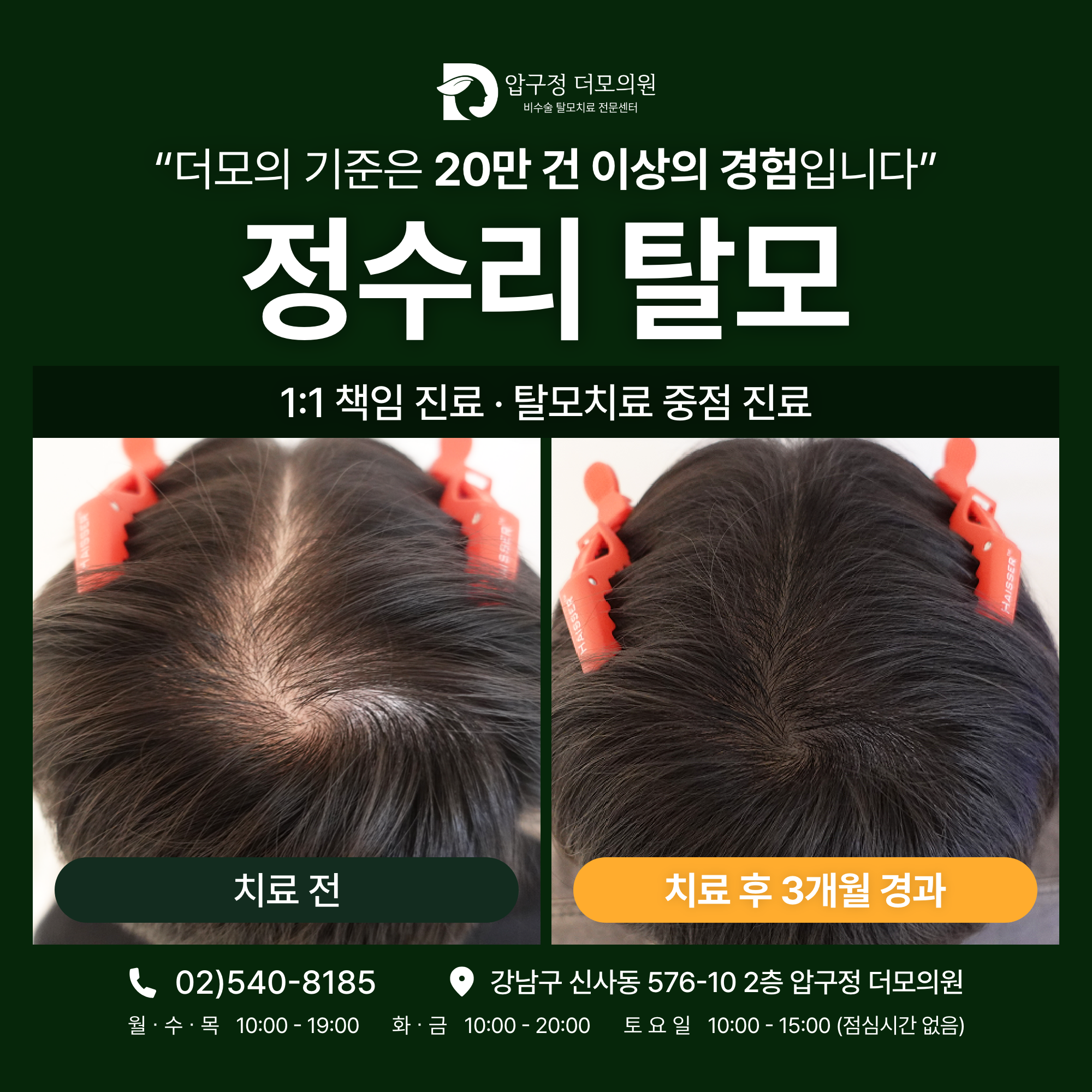 압구정더모의원 내부 전경