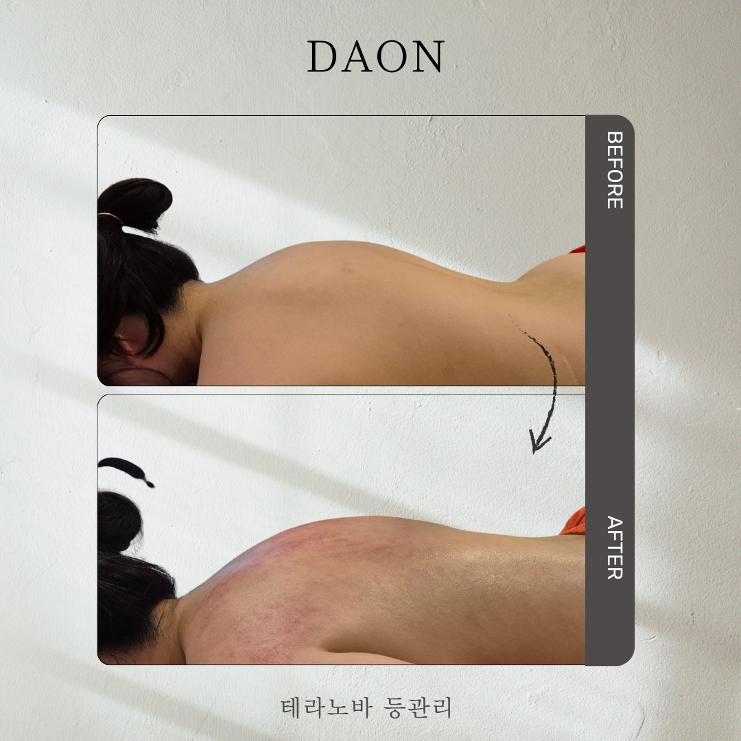 다온 마사지남양주센타 photo 9