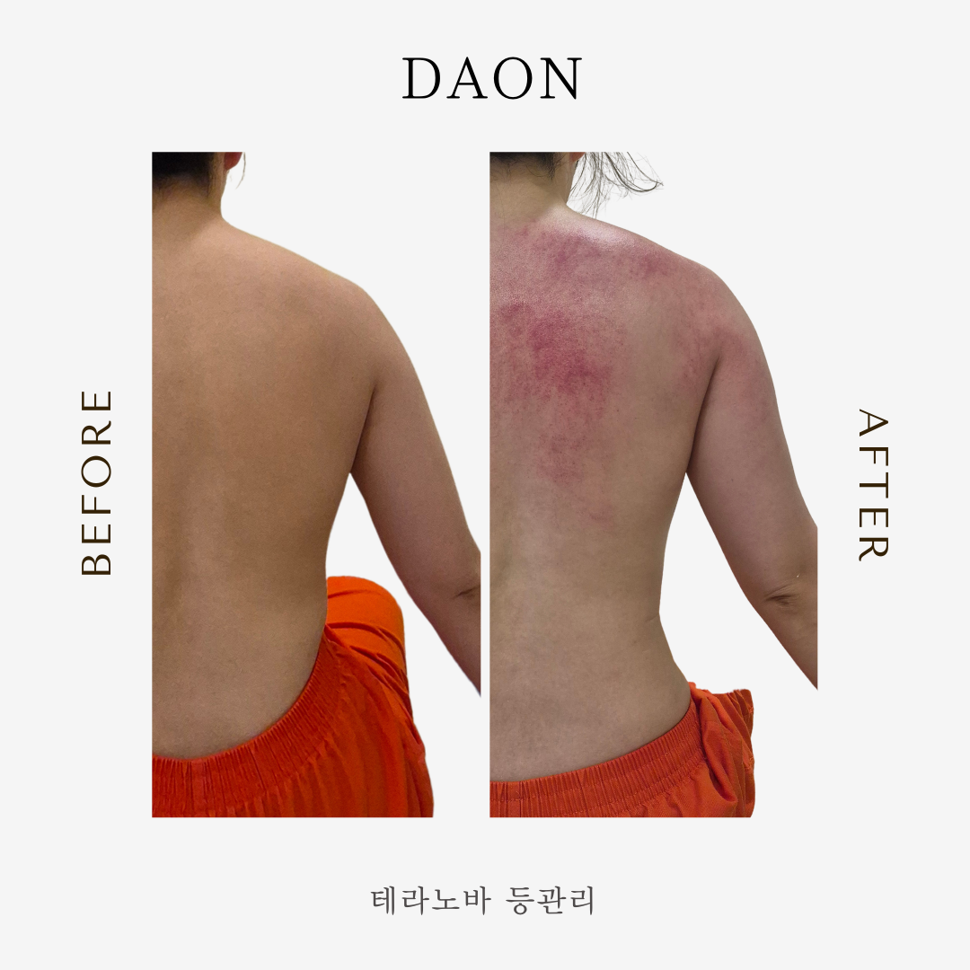 다온 마사지남양주센타 photo 7