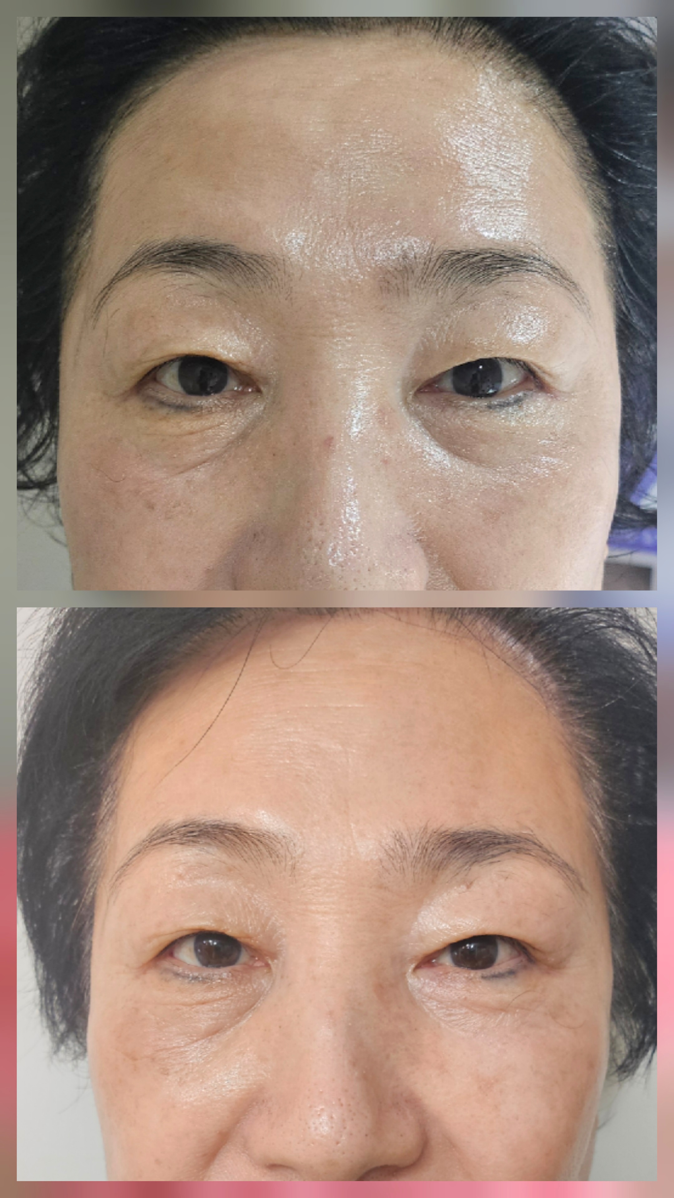나피부스킨케어 대표 이미지