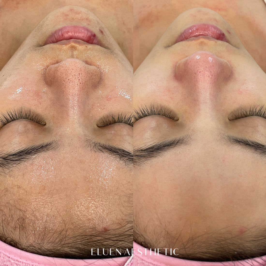 엘루엔에스테틱 대표 이미지