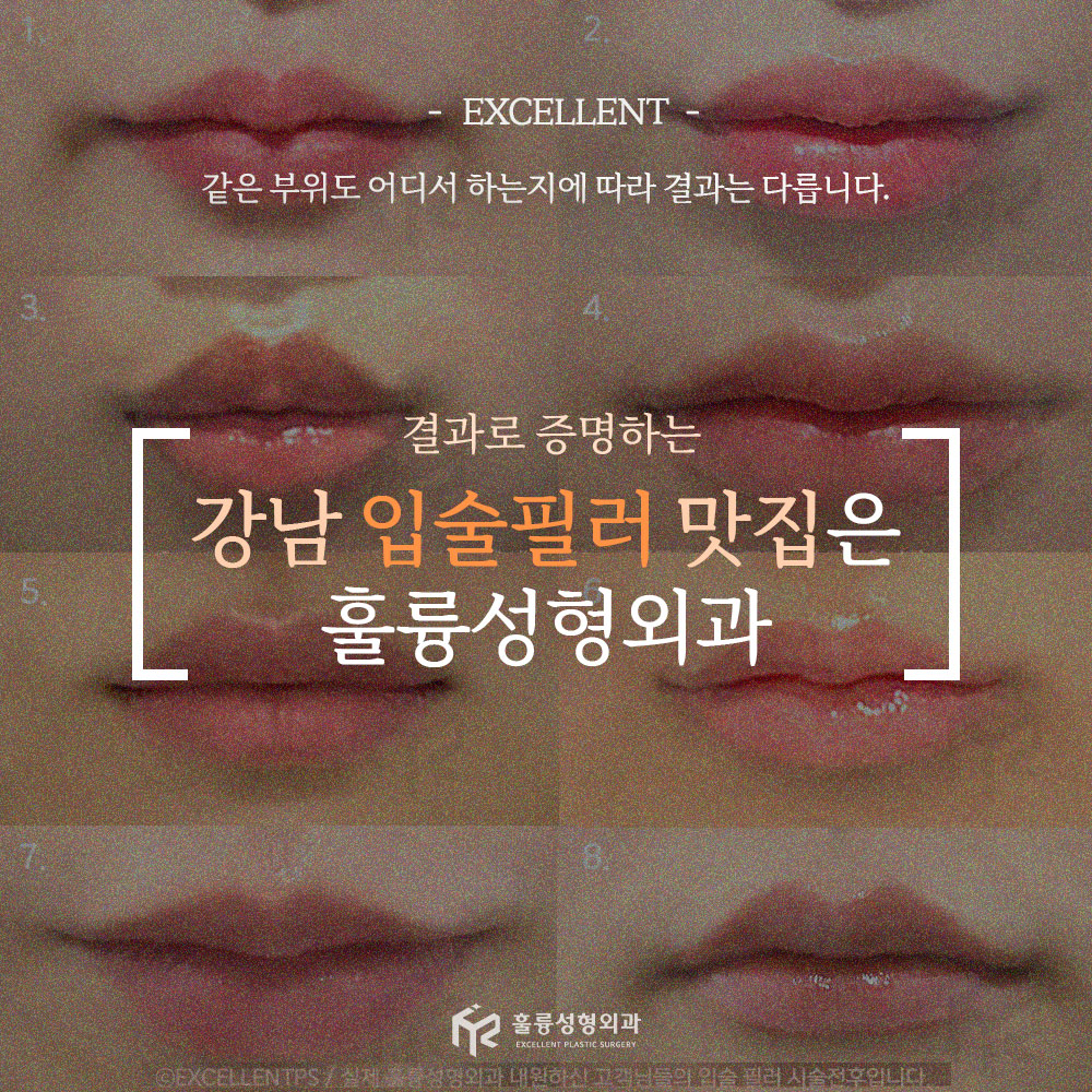 훌륭성형외과의원 대표 이미지