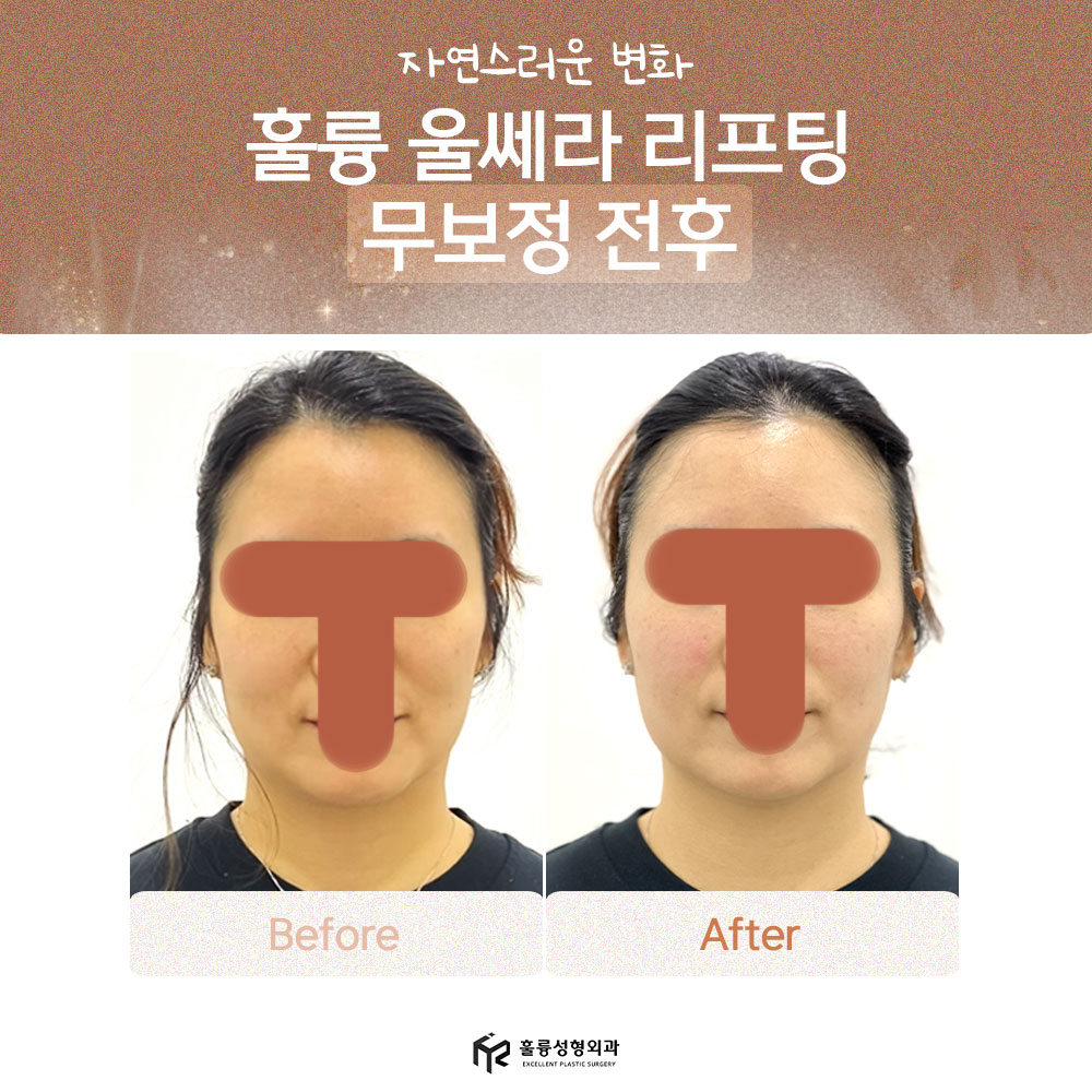 훌륭성형외과의원 대표 이미지