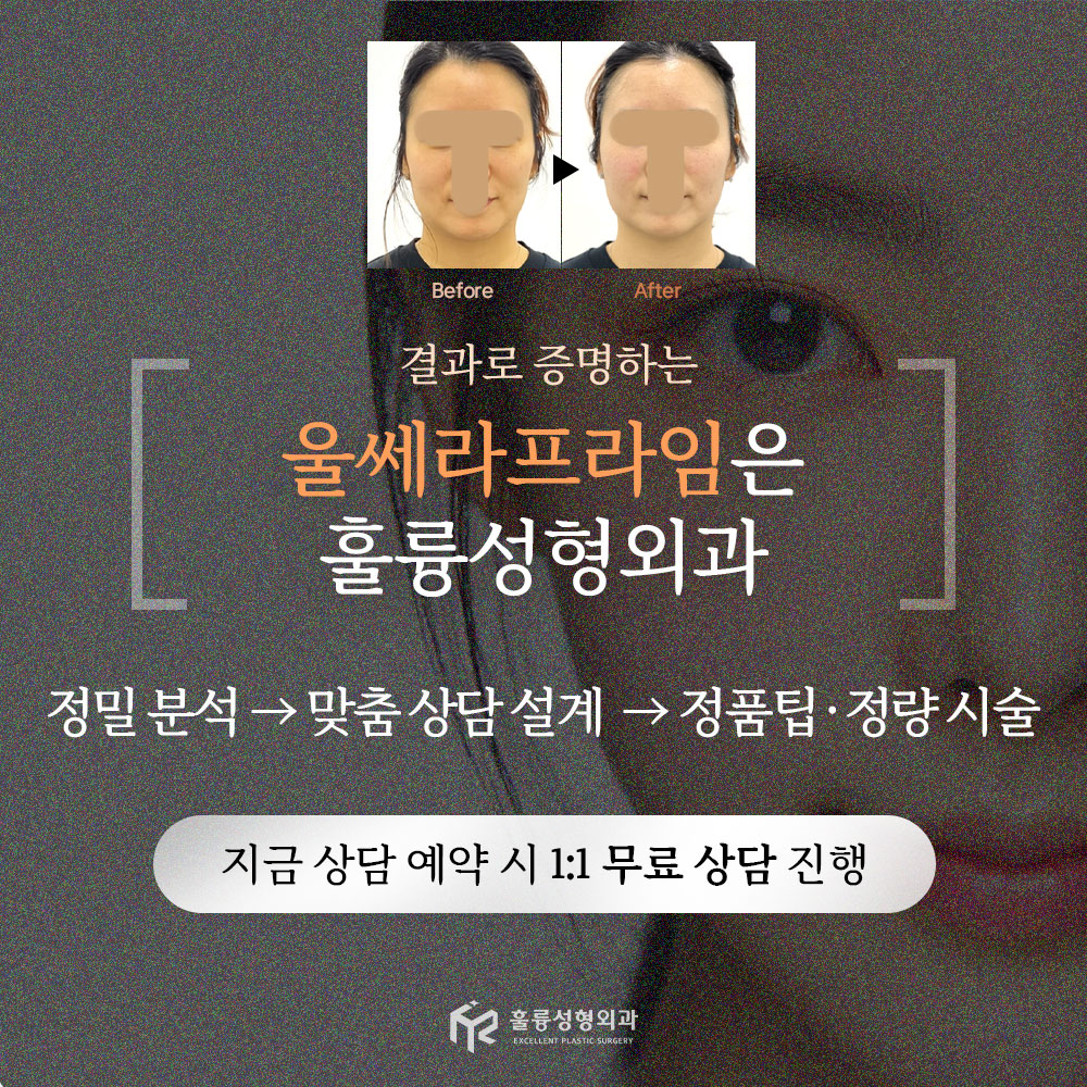 훌륭성형외과 대표 이미지