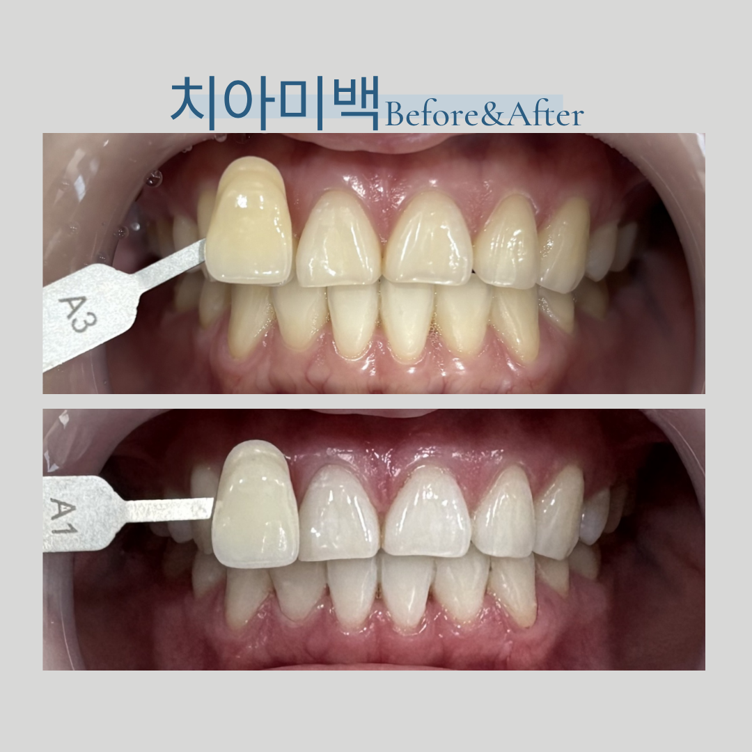서울새봄플란트치과 대표 이미지