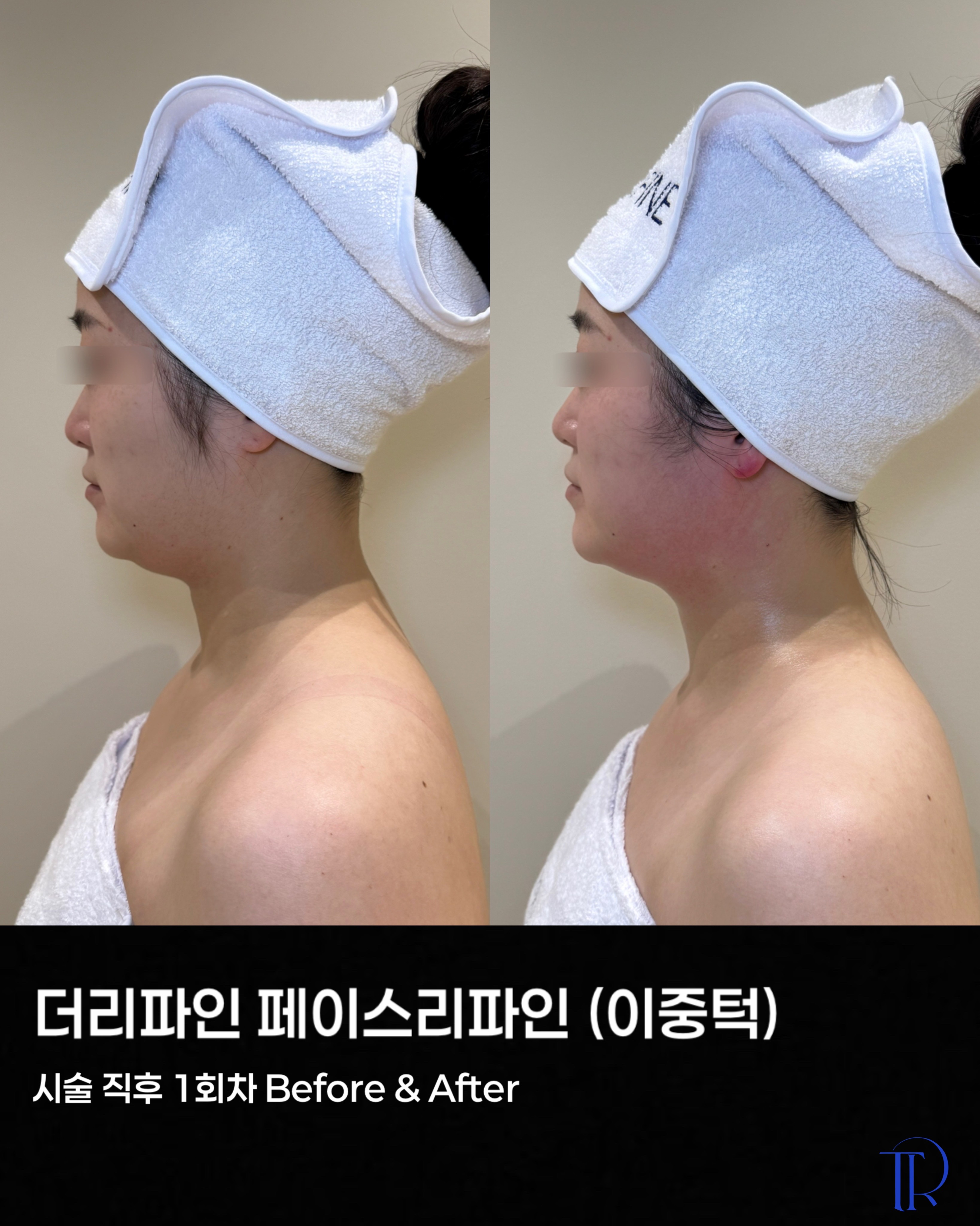 더리파인에스테틱 대표 이미지