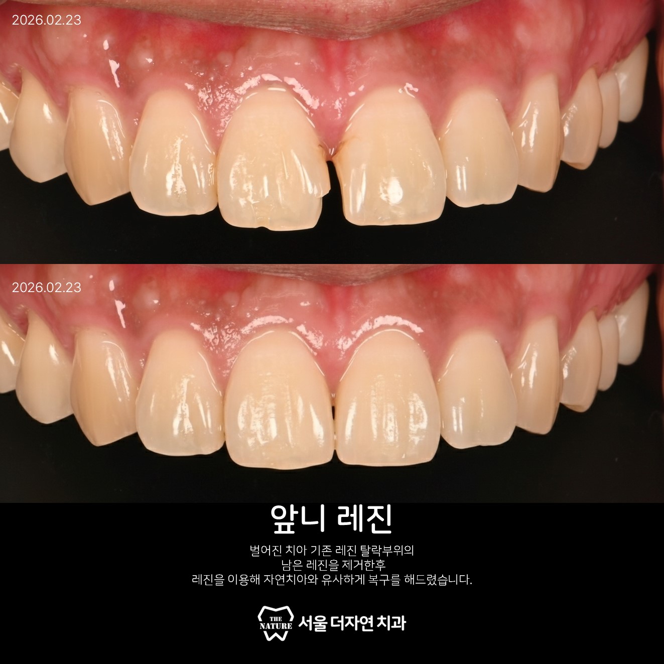 서울더자연치과 대표 이미지