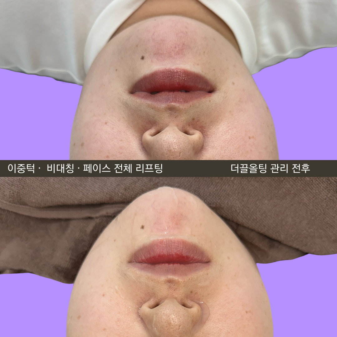 늘그린스킨 대표 이미지