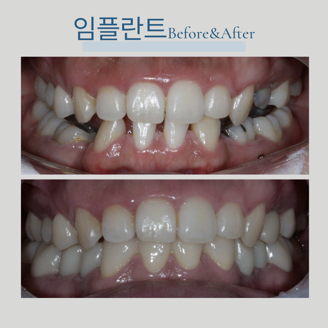 서울새봄플란트치과의원 대표 이미지