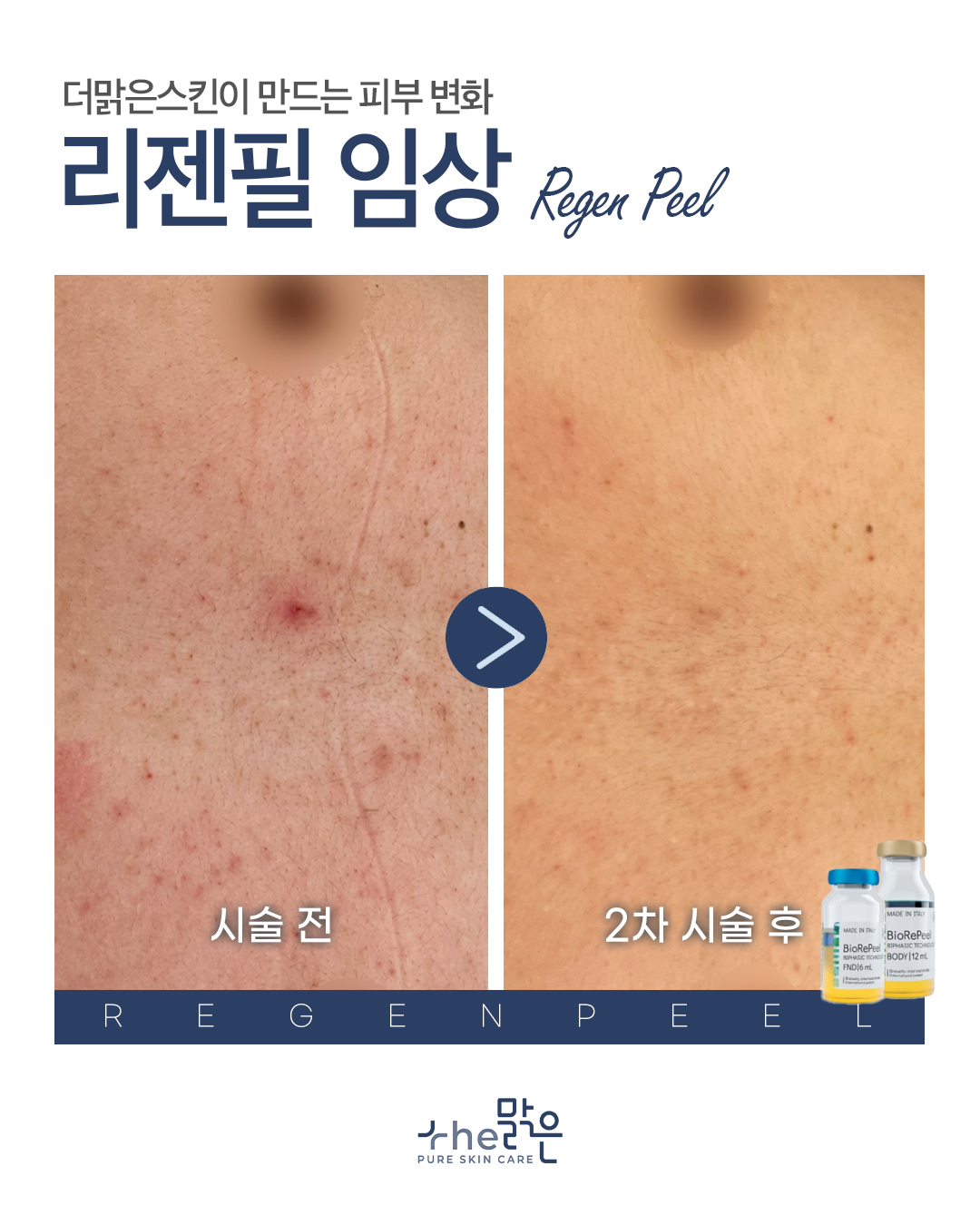더맑은스킨 춘천퇴계점 이미지