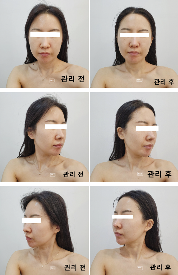 끌리네피부관리 신시가지효자점 photo 2