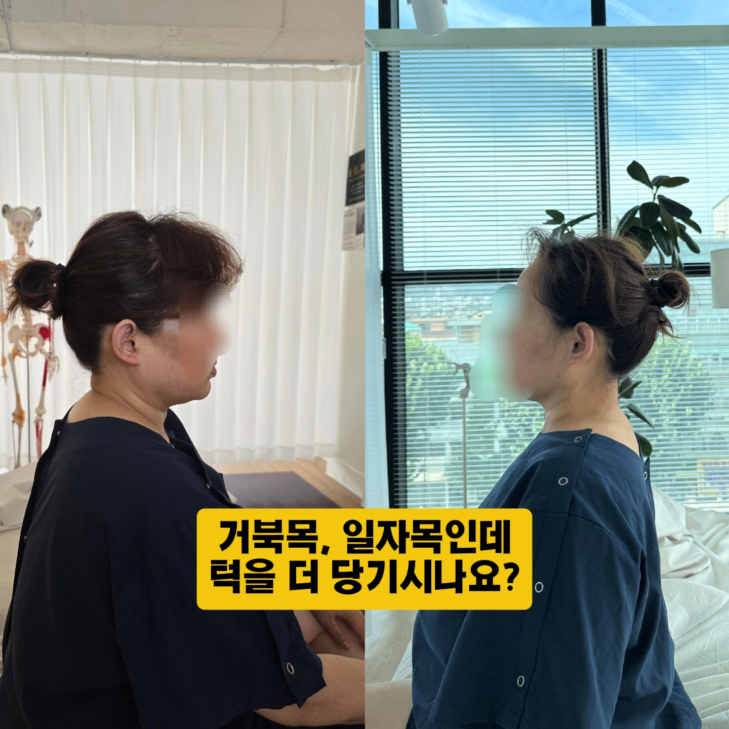 숨쉼제니 체형교정 테라피 잠실 송파 photo 9