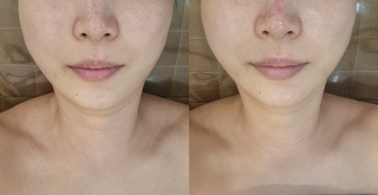 끌리네피부관리 신시가지효자점 photo 4