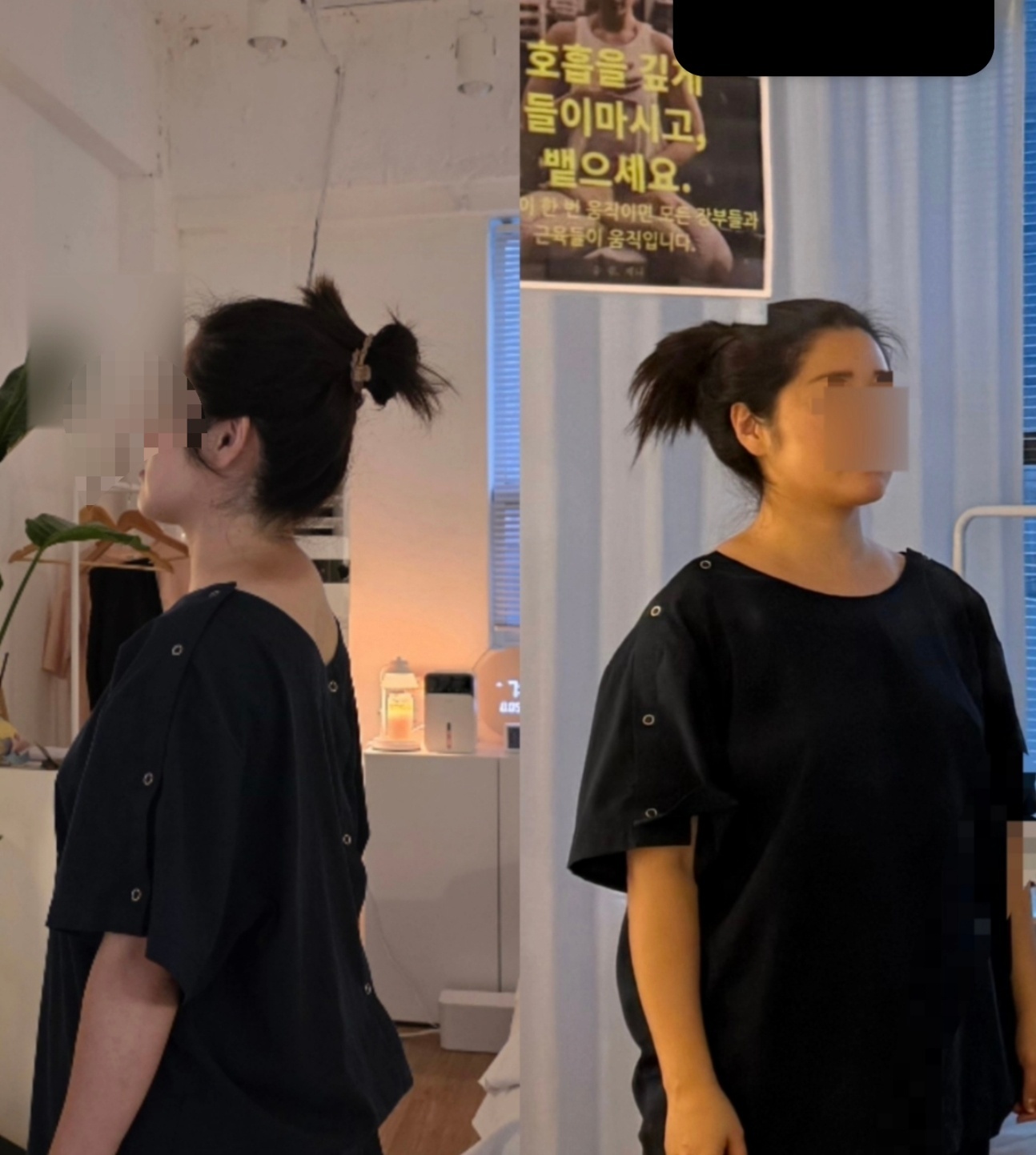 숨쉼제니 체형교정 테라피 잠실 송파 photo 6
