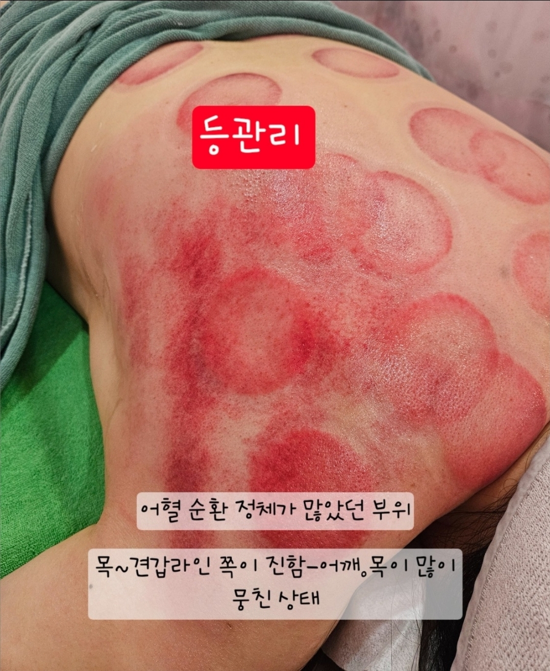 공주피부 오목천점 photo 9