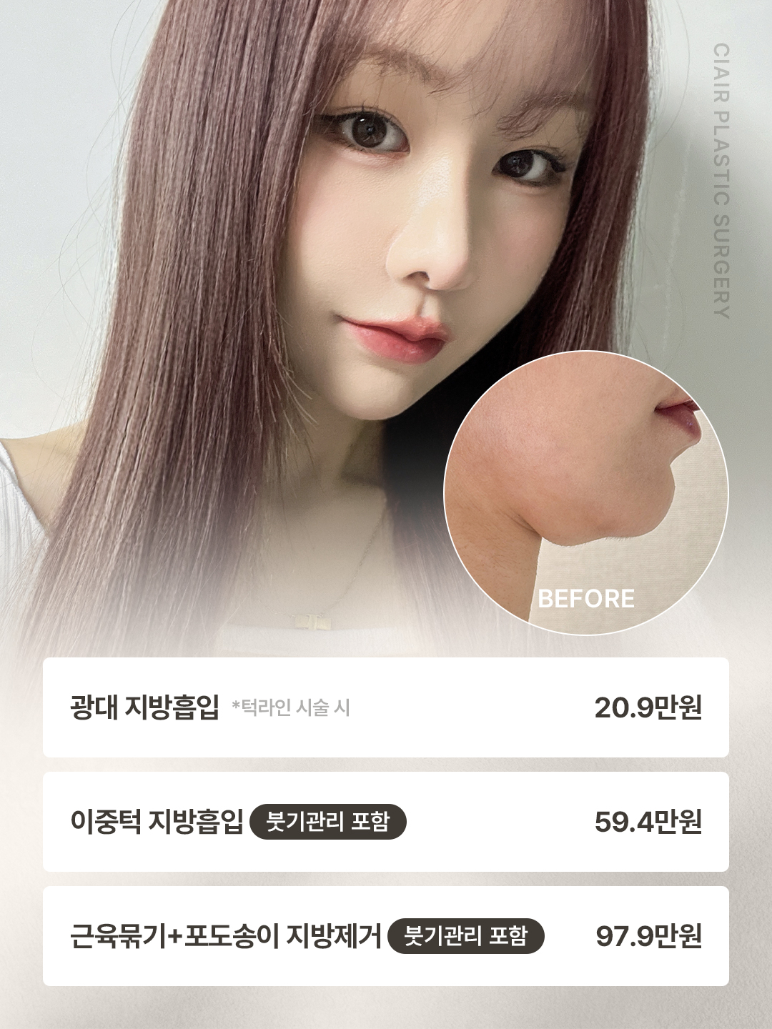 클레어성형외과 대표 이미지