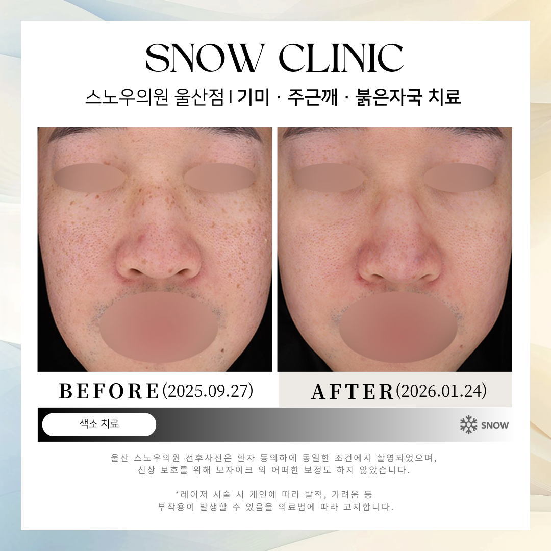 스노우의원 울산점 대표 이미지