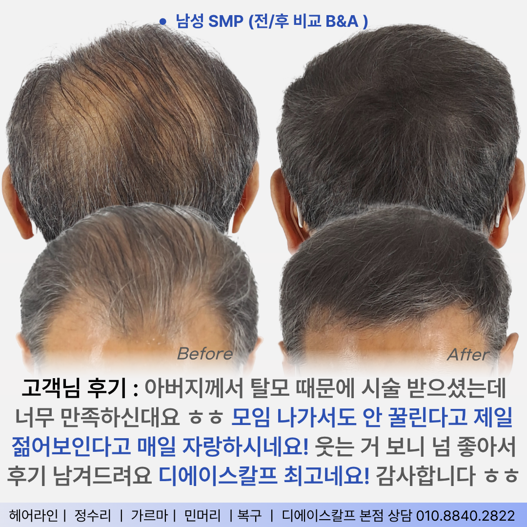 디에이스칼프 대구본점 대표 이미지