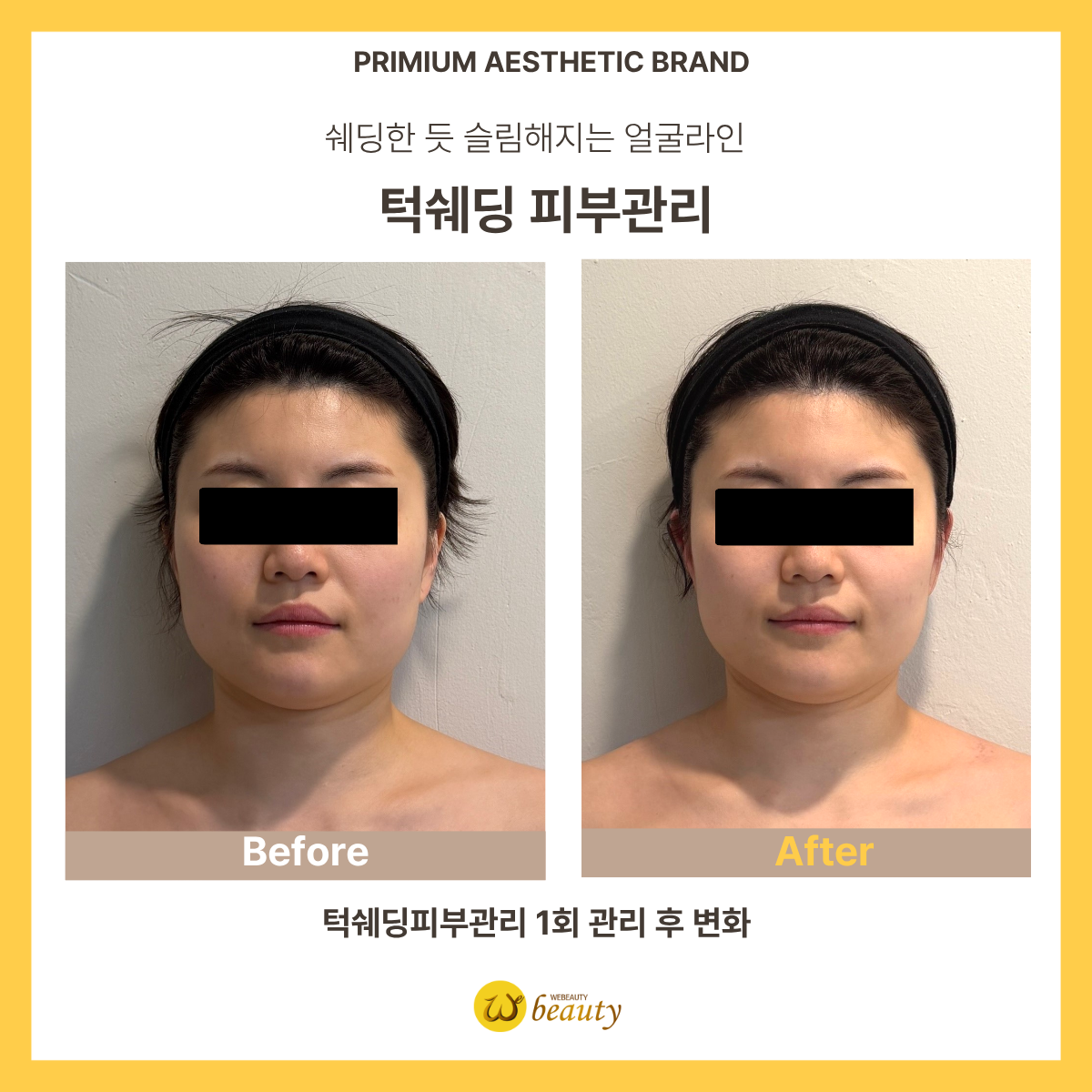 위뷰티 여의도점 photo 6