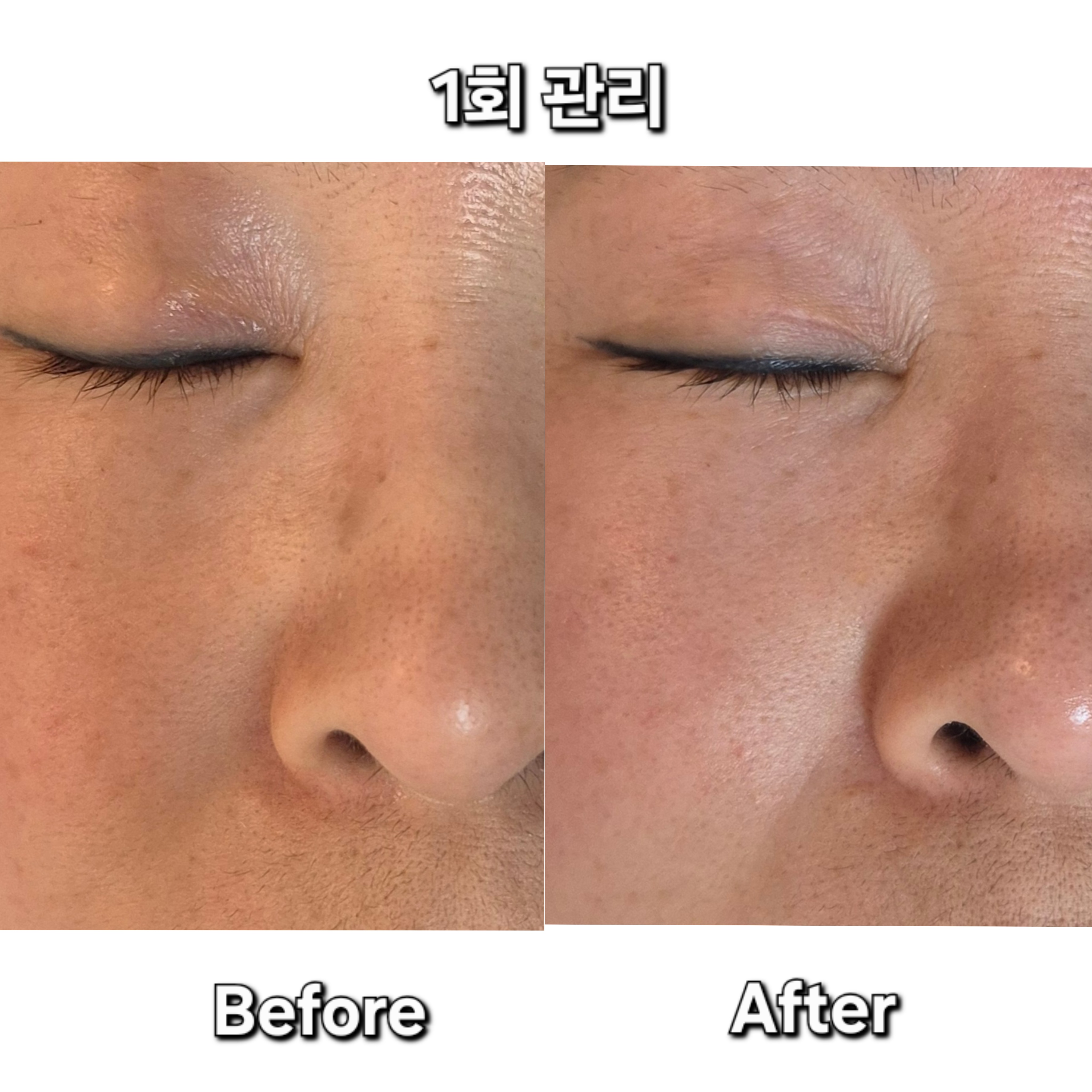 청담엑스날 철원점 photo 6
