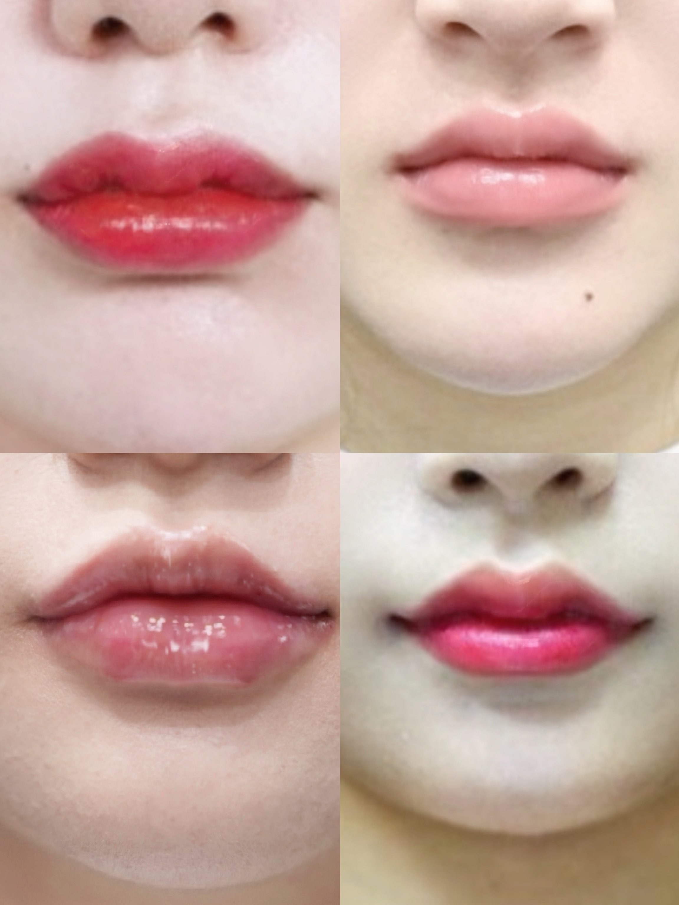 닥터쁘띠의원 홍대점