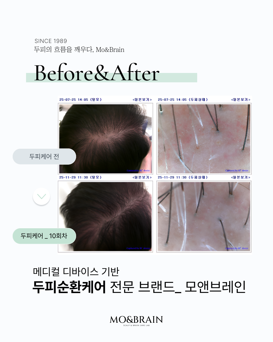 모앤브레인 대표 이미지
