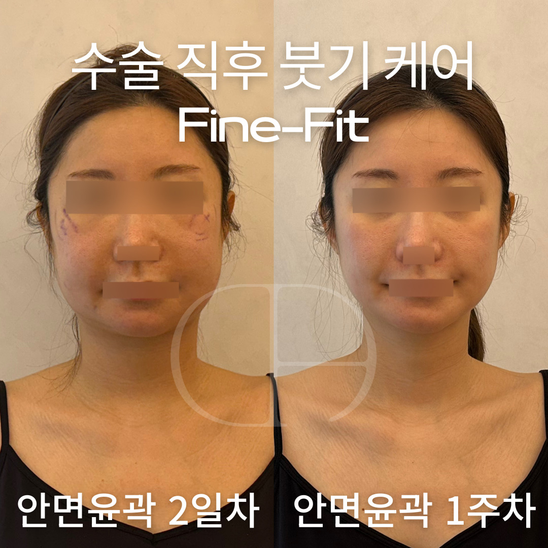 다이아에스테틱 대표 이미지