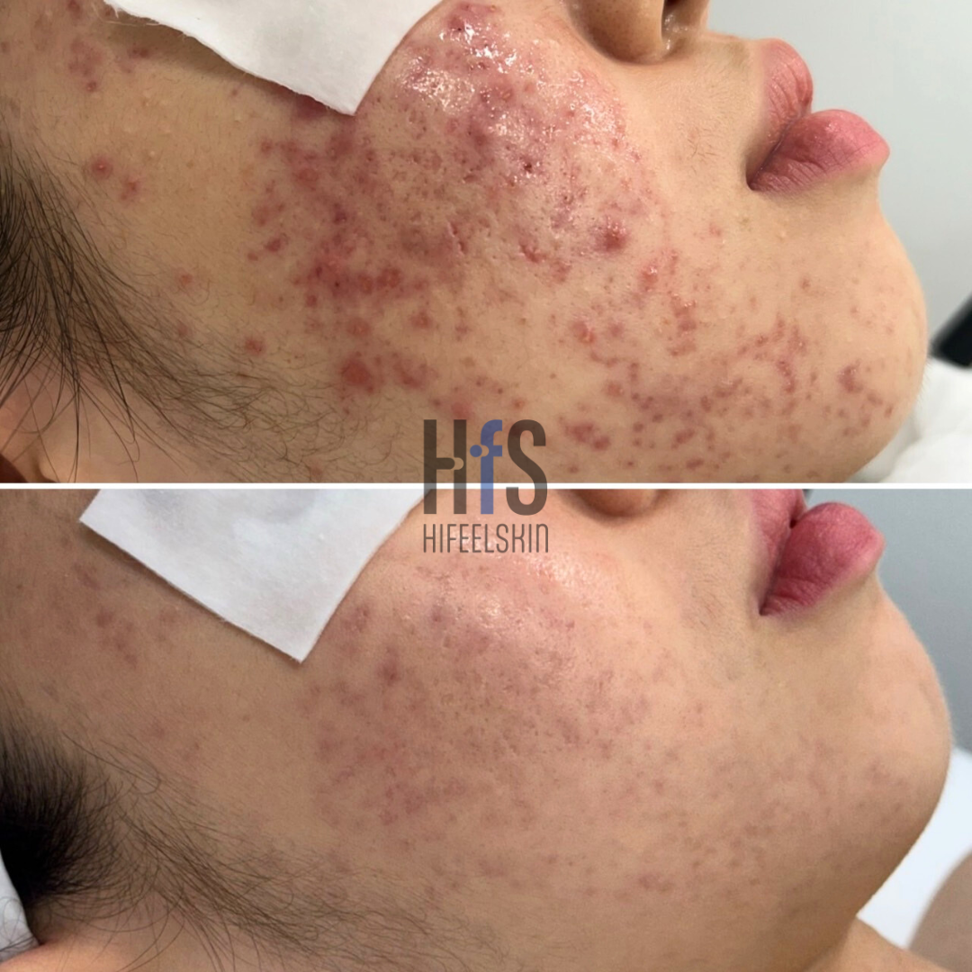 하이필스킨 여의도점 대표 이미지