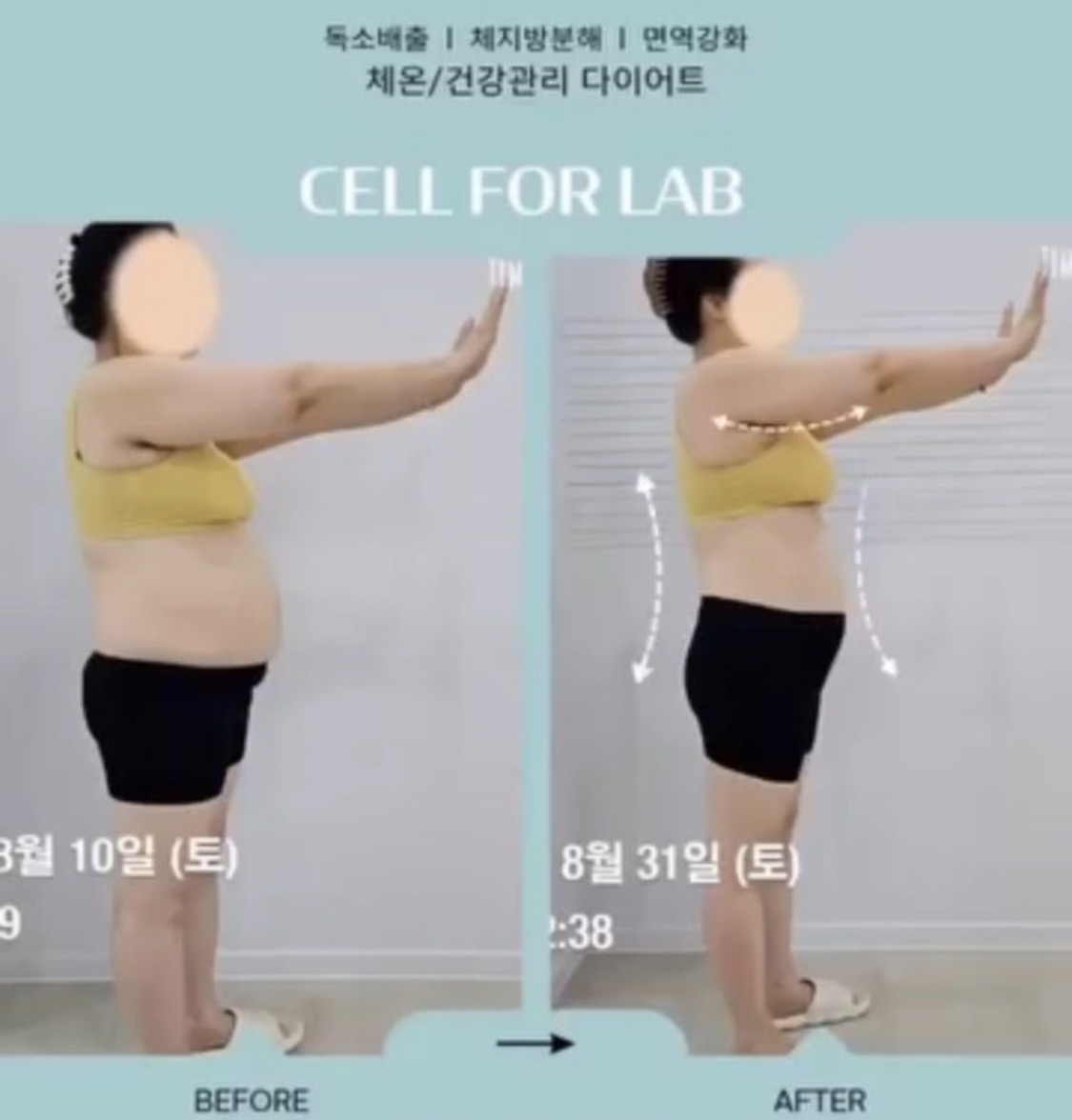 셀포랩 원티어 photo 6