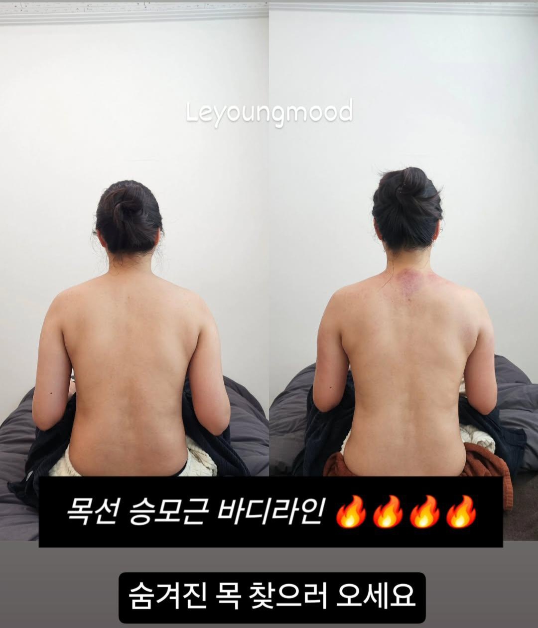 르영무드 대표 이미지
