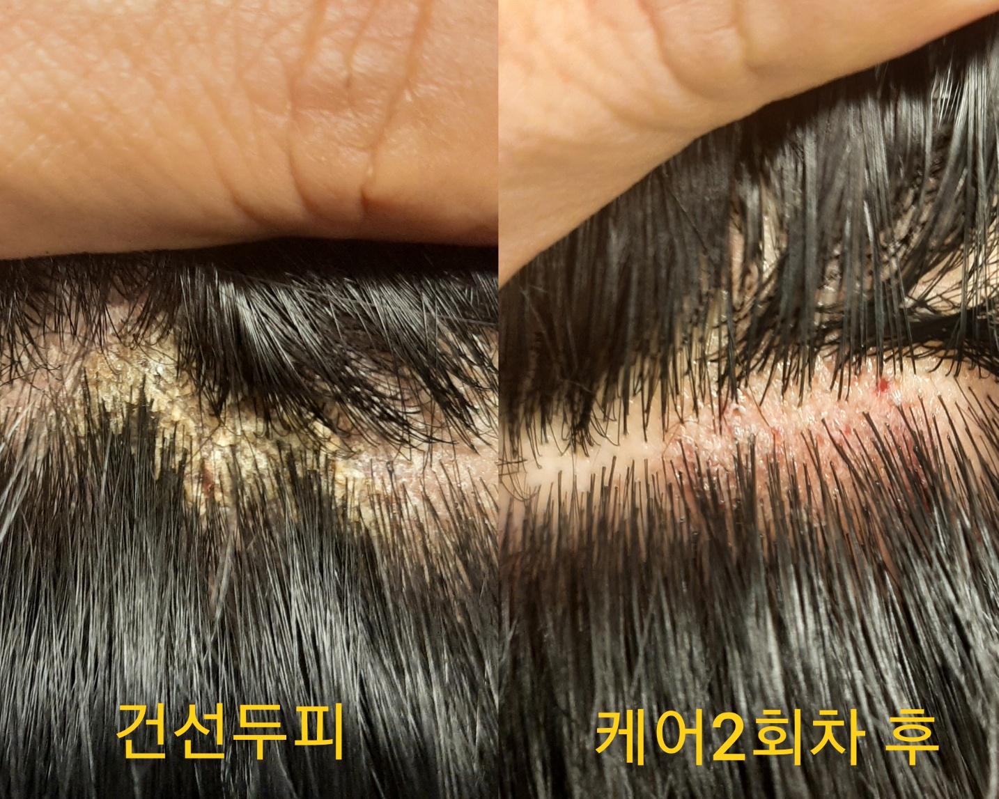 숲칼프 가산점 대표 이미지
