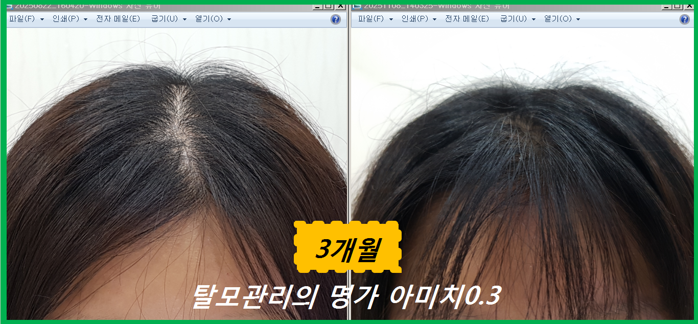 아미치 0.3 대표 이미지