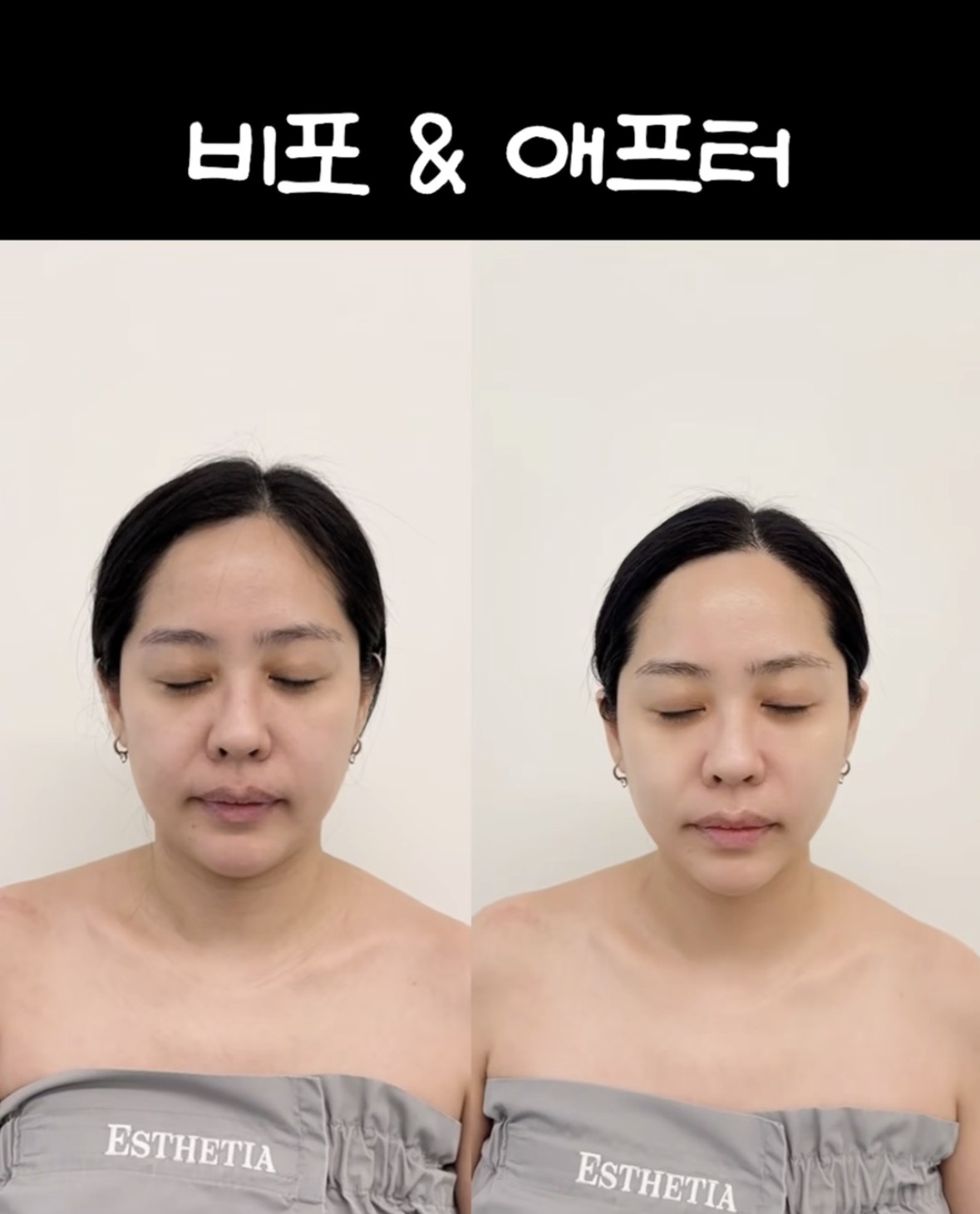 에스테티아 송도1호점 photo 2