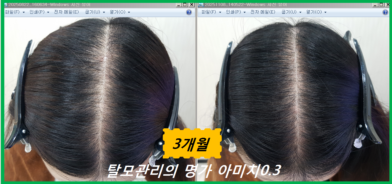 탈모 아미치 0.3 공덕점 대표 이미지