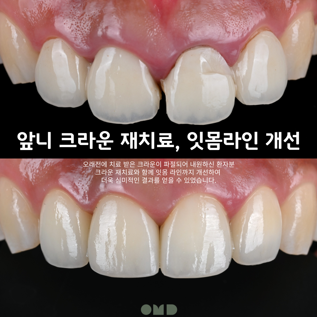 이보다치과 대표 이미지