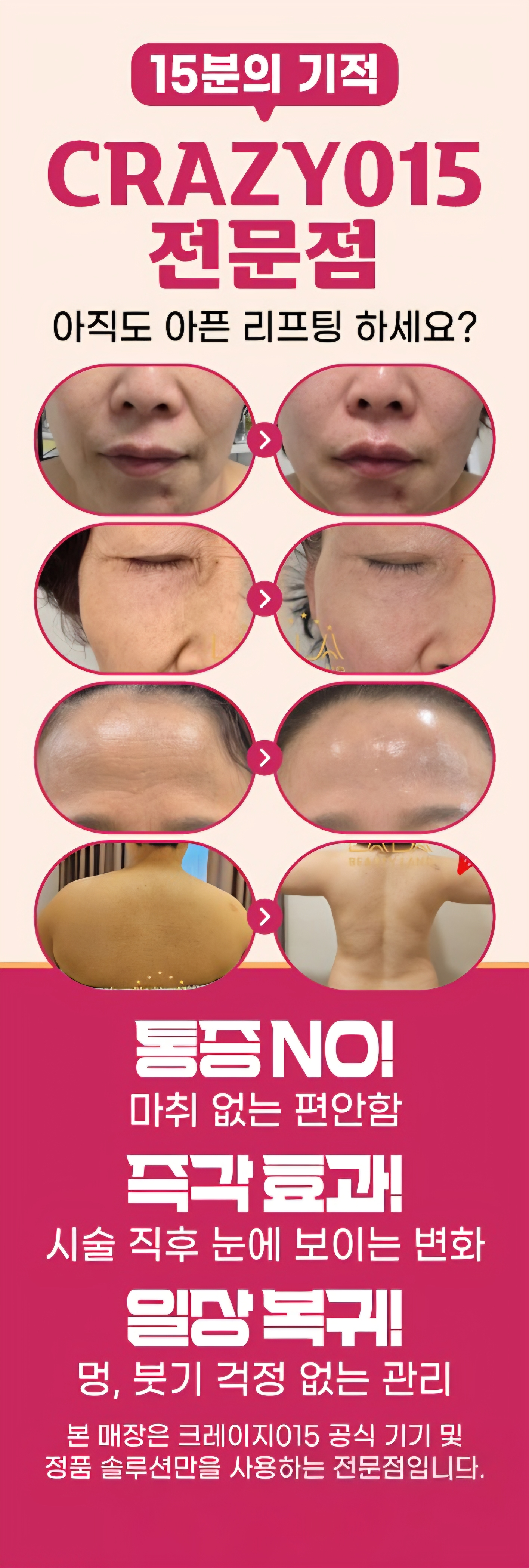 별내 와이뷰라인