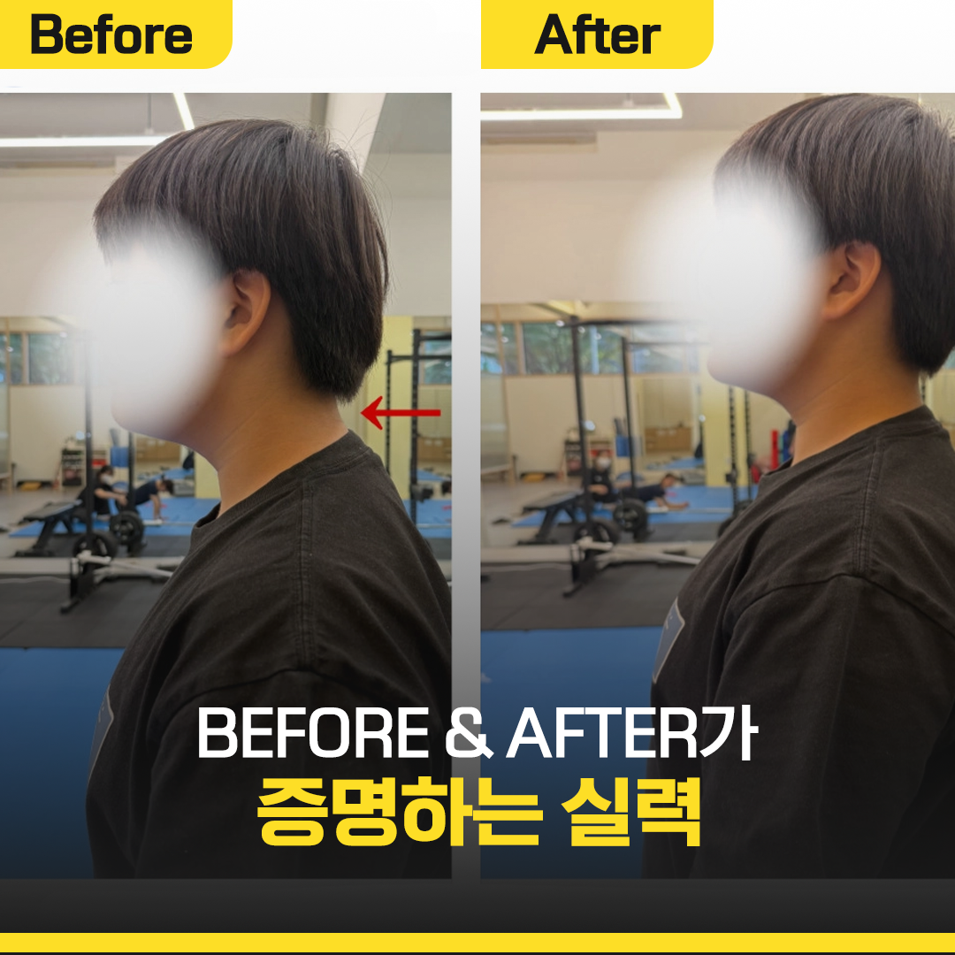 클래스바디 체형교정센터 수원광교점 photo 4